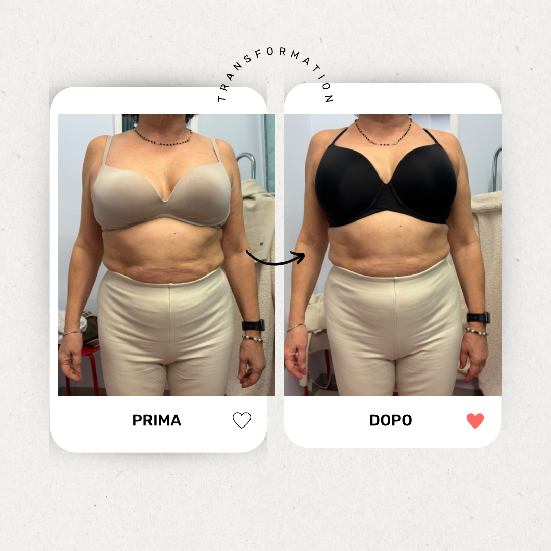 Consulenza Bra Fitting in Negozio – La tua taglia perfetta di reggiseno in un’ora
